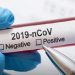 Coronavírus: Baixo Guandu continua sem registro de casos positivos